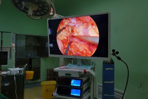 surgical camera