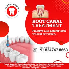 Root Canal Treatment