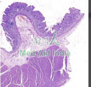 Stomach Pylorus Histology Slide