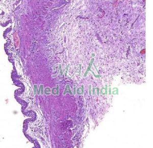 Urinary Bladder Histology Slide
