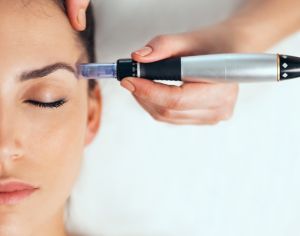 Derma Pen Microneedling Treatment