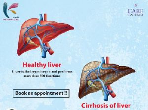 liver fibroscan service