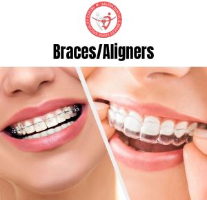 dental brace