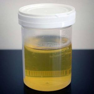 Cow Urine