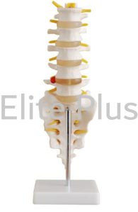 Life-Size Lumbar Vertebrae with Sacrum & Coccyx and Herniated Disc