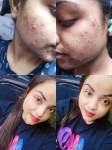 Fair Skin Magic Cream