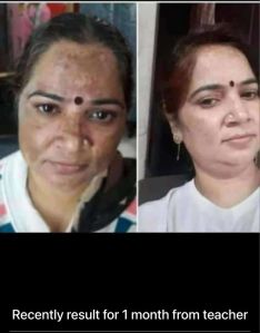 Fair Skin Magic Cream