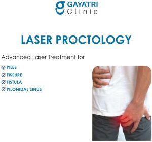 proctology laser treatment