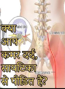 Sciatica Treatment