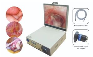 Portable Video Endoscopy System Hdvue Camera SY-P003