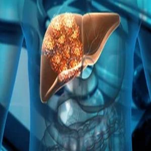 Liver Cancer Treatment Service