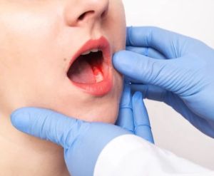 Oral Cancer Treatment Service