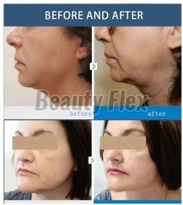 Beautrix Aesthetics 2 in 1 Hifu Machine for Face and Body Contouring