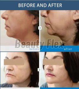 Beautrix Aesthetics 7d HIFU Machine With Vaginal Hifu