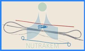 Polyurethane Ureteral Indwelling Double Pigtail Stent Set