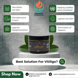 anti vitiligo cream