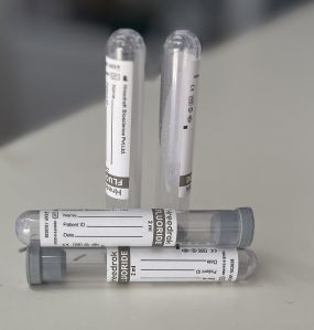 Fluoride Single Cap Blood Collection Tube