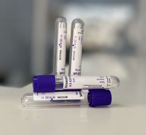 K3 EDTA Vacuum Blood Collection Tube