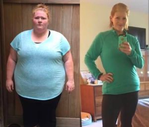 Bariatric Surgery Service