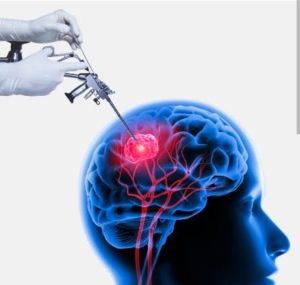 Neuro Surgery Service