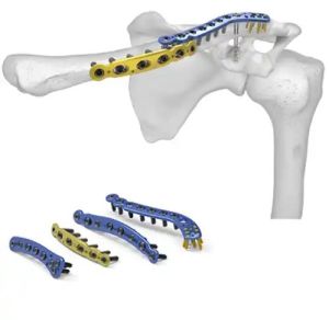Orthopedic Implants