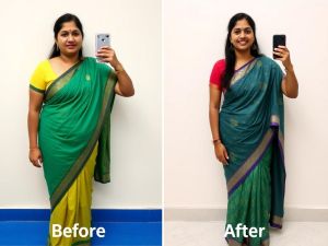 Weight Loss Programs