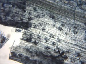 Vesicular Arbuscular Mycorrhiza