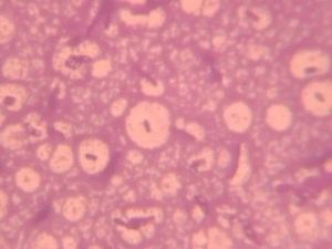 Azotobacter Bio Fertilizer