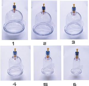 cupping therapy cupping set