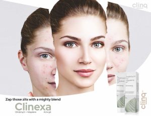 Clindamycin and Adapalene Gel