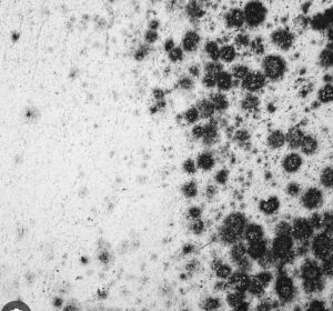 Antifungal Treatment Service