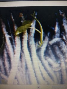 Neem Giloy Root