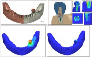 Finite Element Analysis Services