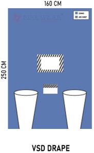 Vsd Drape