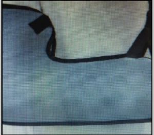 Elbow Sling