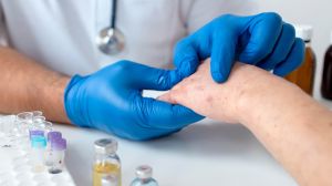 Skin Allergy Treatment Service