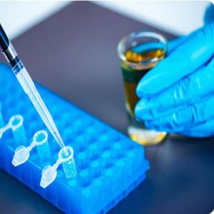 Nitrogen Transformation Test