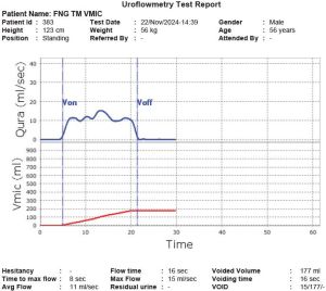 Wired Auto-Tersus OS Based Self Cleaning Uroflowmeter