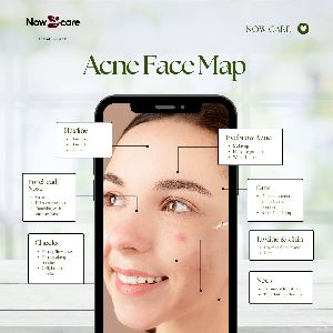 Aloe Vera Powder