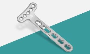 Distal Radius Extra Articular Locking Plate