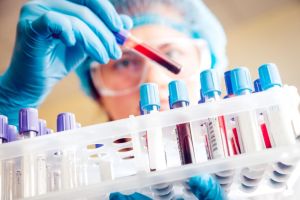 Acute Avian Toxicity Test