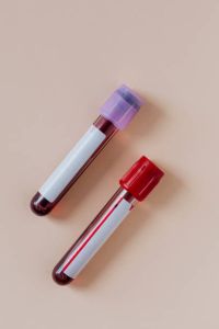 Blood Collection Tube