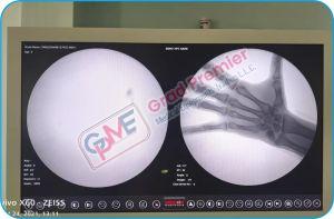 GRDLIV-II Grad C Arm X Ray Machine
