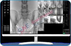 Grdliv - Fp  Grad C Arm X Ray Machine