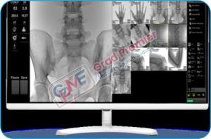 GRDLIV-II Grad C Arm X Ray Machine