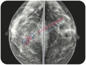 Grad Pink Series Mammograd Mamography