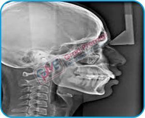 Grad Dental Pearl Series Ortho Pantomogram Machine