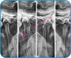 Grad Dental Pearl Series Ortho Pantomogram Machine