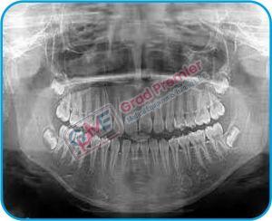 Grad Dental Pearl Series Ortho Pantomogram Machine