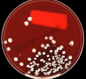 Aerobic Microbial Culture